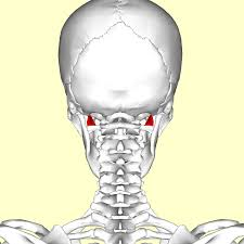 <p>Origin:</p><ul><li><p><span style="background-color: transparent;"><span>Jugular process of occiput</span></span></p></li></ul><p>Insertion:</p><ul><li><p><span style="background-color: transparent;"><span>TP atlas (C1)</span></span></p></li></ul><p>Nerve:</p><ul><li><p><span style="background-color: transparent;"><span>Anterior rami C1</span></span></p></li></ul><p>Action:</p><ul><li><p><span style="background-color: transparent;"><span>Lateral flexion of head on neck, stabilises head</span></span></p><p><span style="background-color: transparent;"><span>on neck</span></span></p></li></ul><p></p>