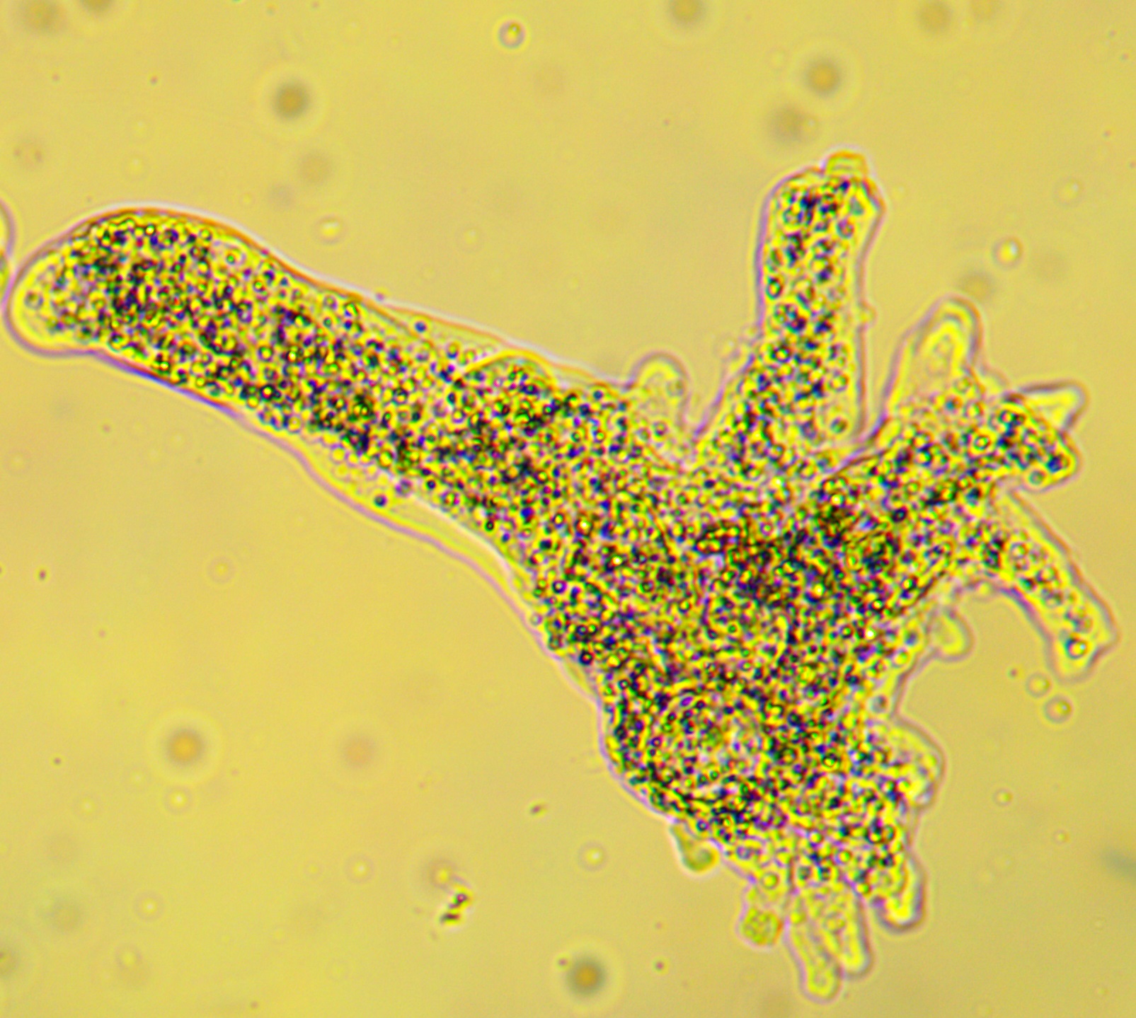 <p>This organism belongs to the phylum ___________ and possesses pseudopodia.</p><ul><li><p>Gymnamoeba</p></li><li><p>Euglenozoa</p></li><li><p>Radiolaria</p></li><li><p>Ciliphora</p></li></ul><p>And what is the organism?</p>