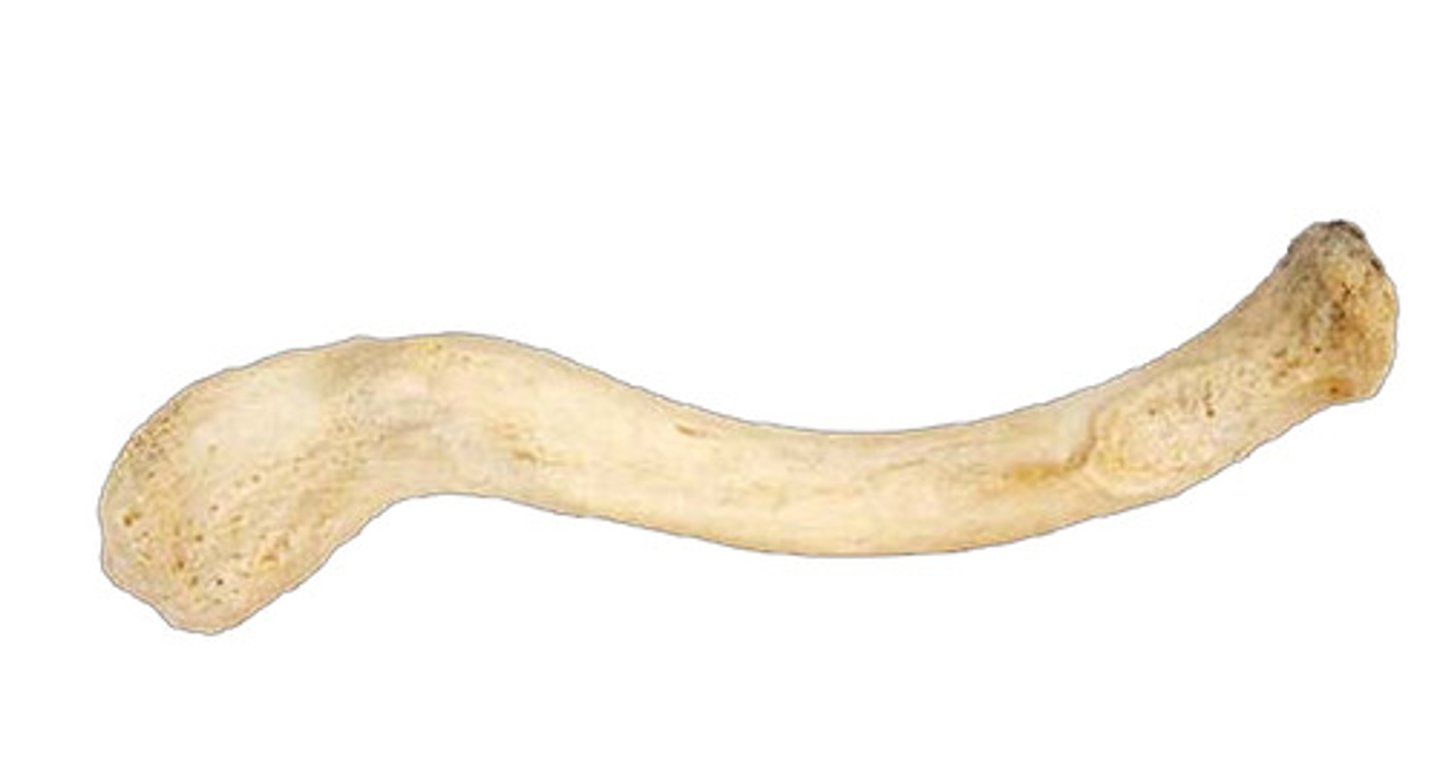 <p>Identify this bone.</p>