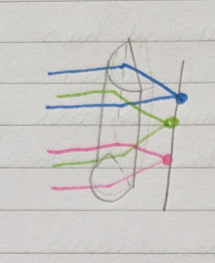 <p>A lens that has one principle meridian of zero refractive power, and the other principle meridian with a different refractive power. Cylindrical lenses cause light to converge at different points depending on where it hits the lens, forming a <strong>line image</strong>. They can be identified as their edges change width going around the edge, and they will cause image distortion until the 0 meridian is hit. </p>