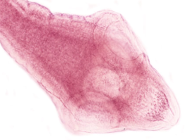 Which cestode does this scolex belongs to?