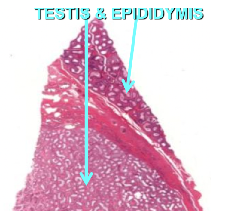 <p>At the upper pole of the testis</p>