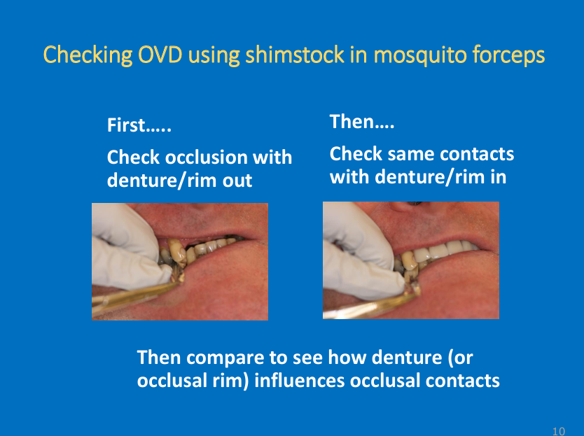 <ul><li><p>use Shimstock with mosquito forceps </p></li><li><p>First check the occlusion/ if the natural opposing teeth are occluding or not with denture/rim out of the mouth - pull on the Shimstock to assess the contacts</p></li><li><p>Then check the same contacts with denture/rim in the patient</p></li><li><p>“The aim is that this is the same - so the natural contacts are still there when you make the denture, if you make a denture that separates these contacts they will be aware it is too high and stops them from chewing properly - might cause them to close jaw tighter causing denture to push into the tissues so don’t want dentures to be too high so you want the correct OVD” (so we’ve done getting the correct horizontal relationship now its about getting the right vertical relationship for the patient)</p></li></ul><p></p>