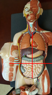 <p>divided by a medial line and transumbilical line</p><ul><li><p>right upper</p></li><li><p>left upper</p></li><li><p>right lower</p></li><li><p>left lower</p></li></ul><p>Umbilicus: point for vertical and horizontal line</p>