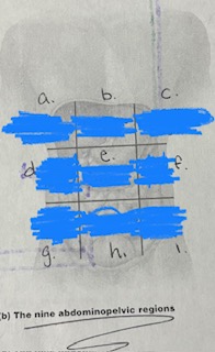 <p>a and c Regions</p>