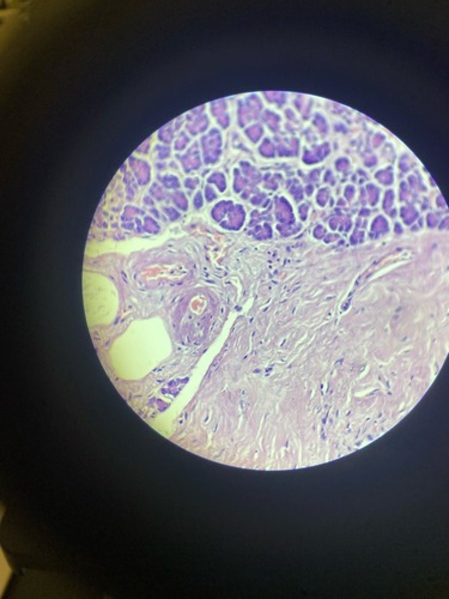 <p>What stain is this?</p>