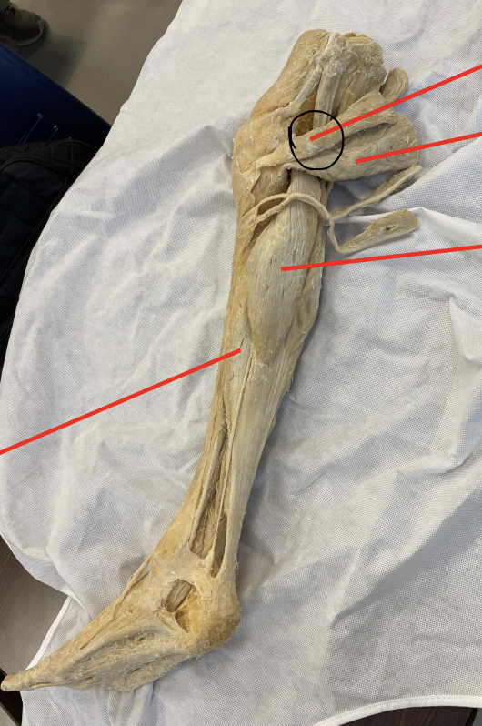 <p>identify + state origin, insertion, action, innervation of marked structure</p>