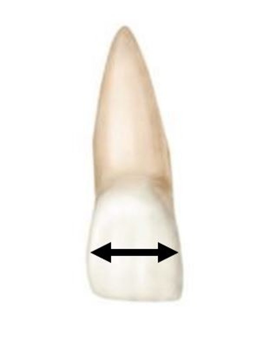 <p>Which direction is this?</p>