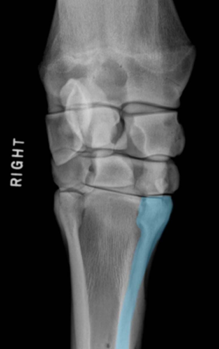 <p>What bone is highlighted?</p>