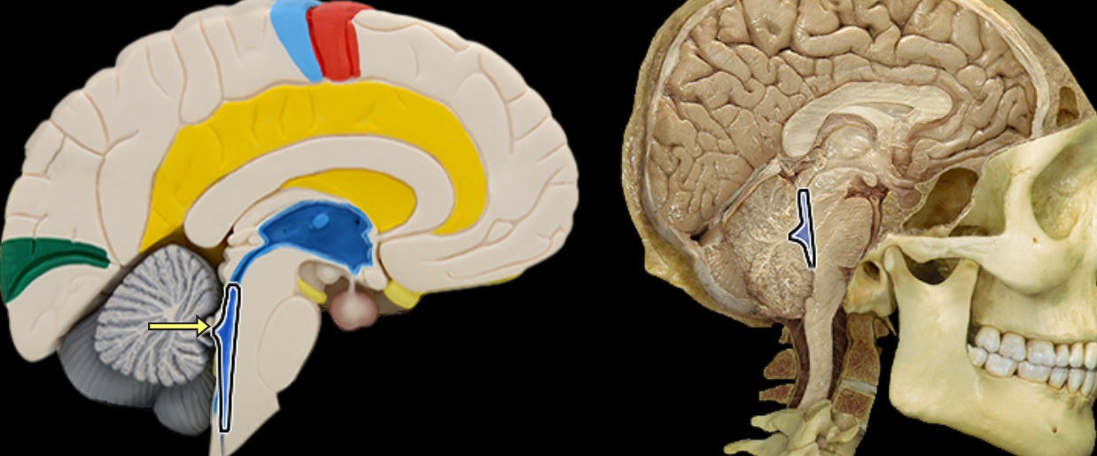 <p>Fourth ventricle</p>
