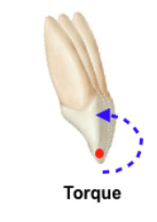 <ul><li><p>when pontics are positioned outside interabutment axis line (line connecting abutement teeth) they can act as a lever arm. </p></li><li><p>Can potentially create a torquing movement, which may affect the stresses occurring in the FPD</p></li></ul><p></p>