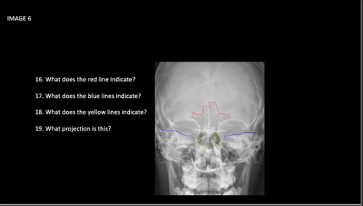 <p>What does the yellow lines indicate?</p>