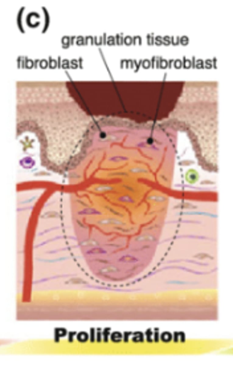<p>Proliferation</p>