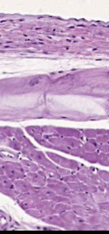 <p>What is the bottom layer?</p>