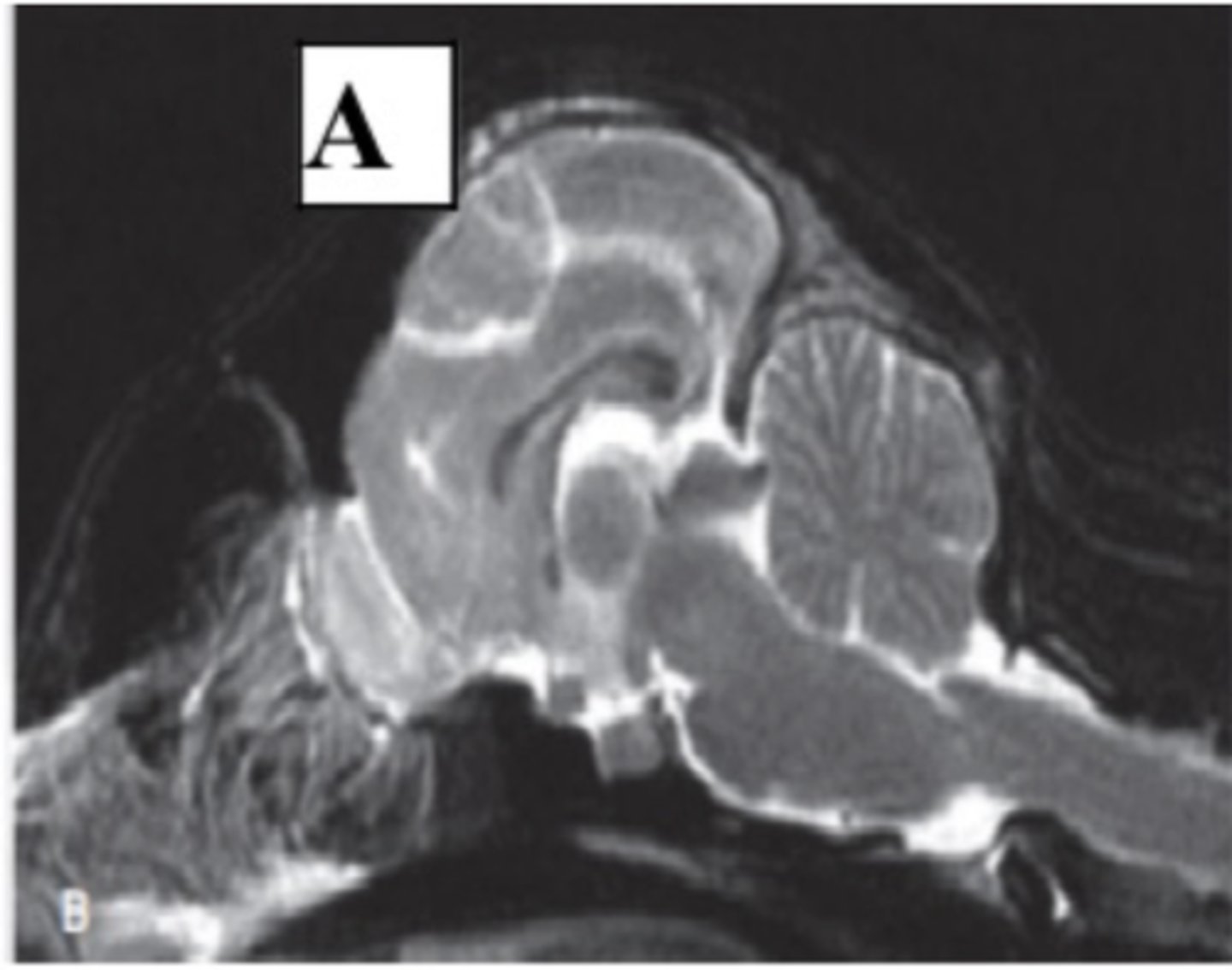 <p>sagital cross section</p>