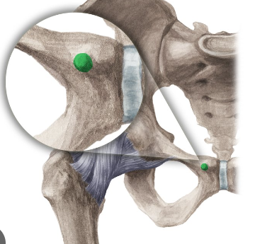 <p>top corner of pubis</p>