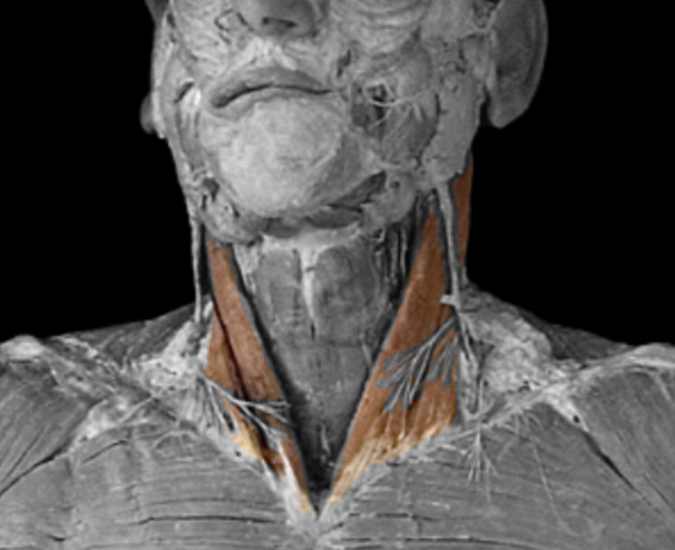 <p>What muscle is this? </p>