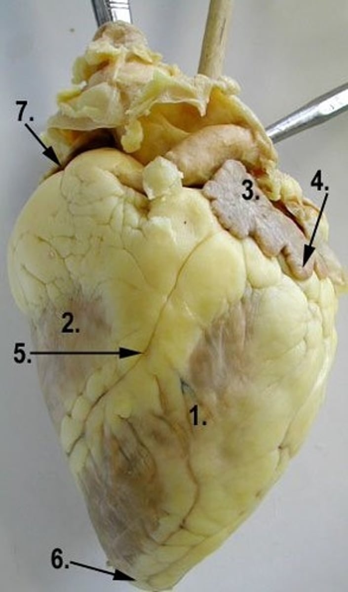 <p>Identify the region of the organ labeled 6</p>