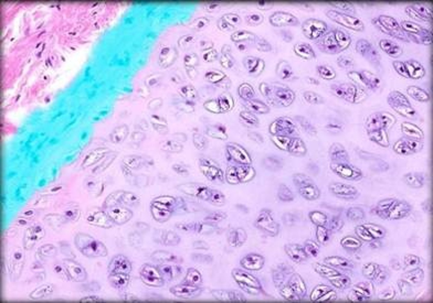 <p>what is dense irregular CT that surround cartilage?</p>