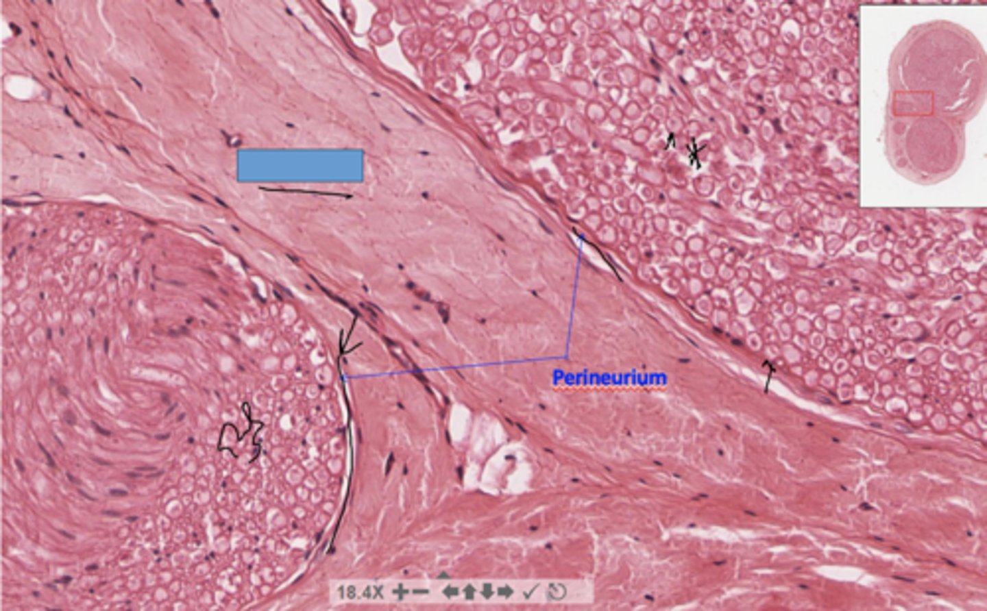 <p>identify the specific structure</p>
