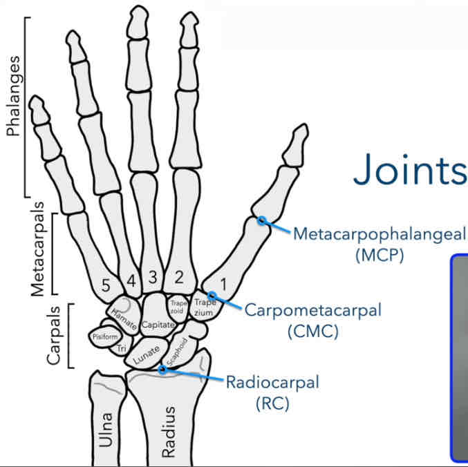 <p>Between the metacarpals and phalanges (knuckles)</p>