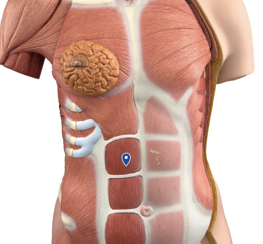 <p>What muscle is the arrow pointing to?</p>