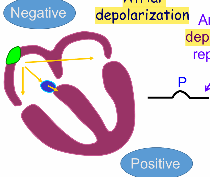 <p>Atrial full depolarization</p>