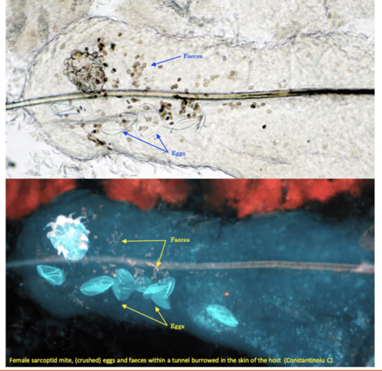 <p>Egg, larva, two nymphal stages and adults -&gt; takes 2-3 weeks to complete</p><p>The fecundated females burrow tunnels in the skin and lay eggs in the tunnels;</p>