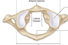 <p>cervical vertebrae (C1)</p>