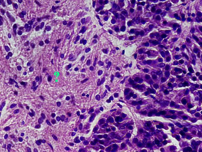 <p><span><span>Identify the indicated region of the pituitary gland.</span></span></p>