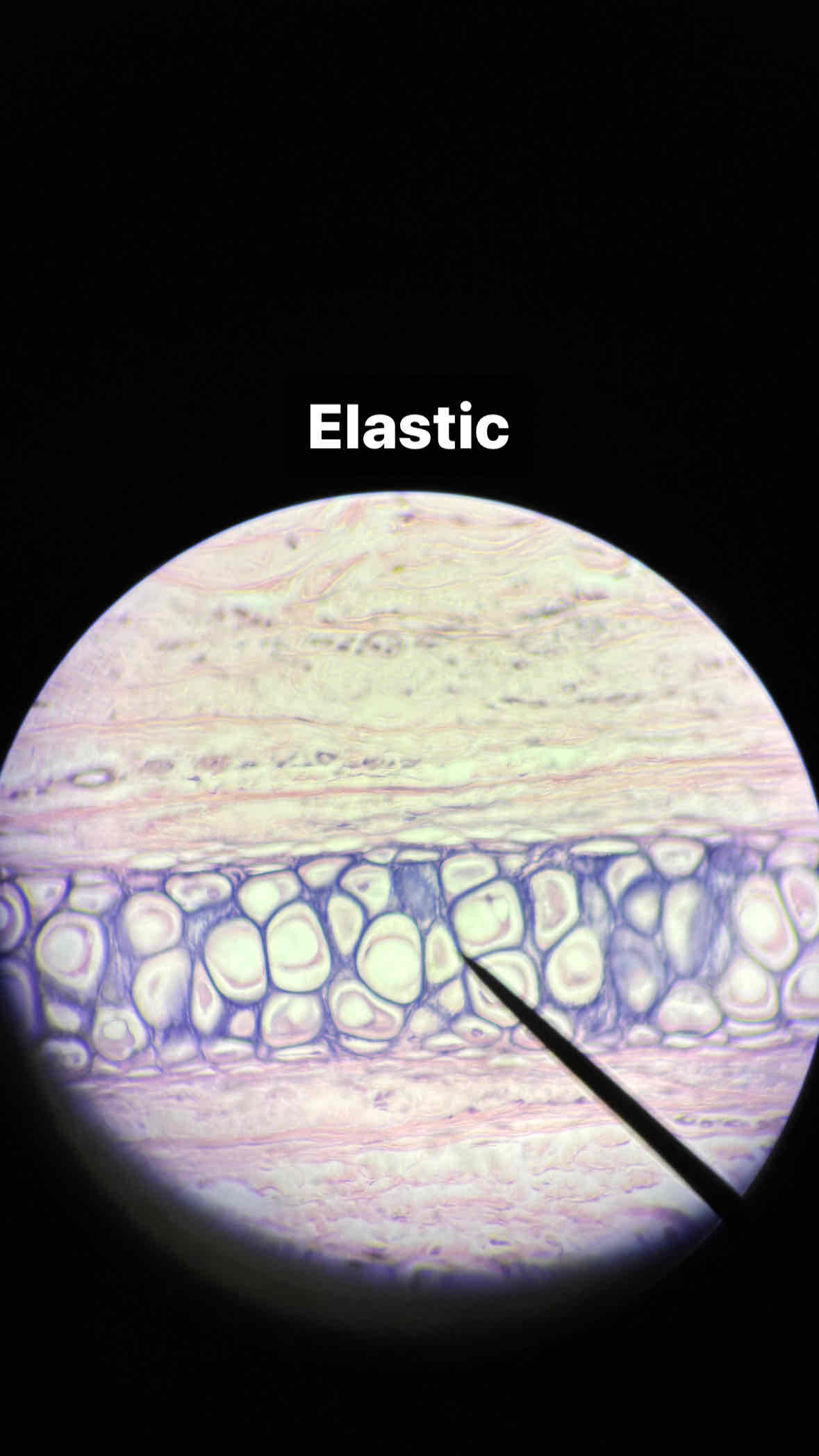 <p>type and subtype of tissue</p>