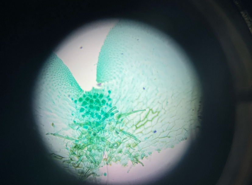 <p>fern prothalium</p>