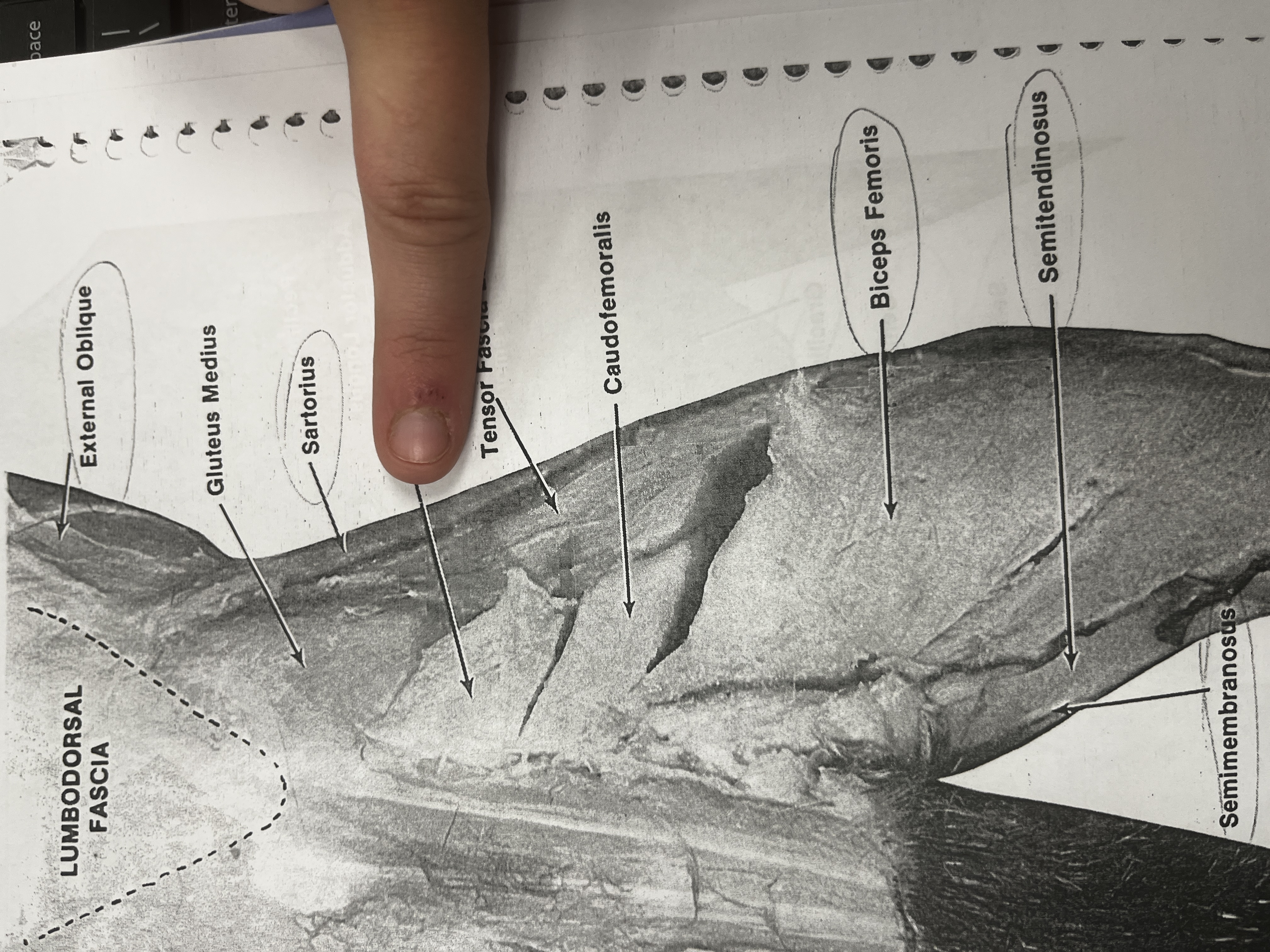 <p>The largest muscle in the human body, involved in the movement of the hip and thigh.</p>