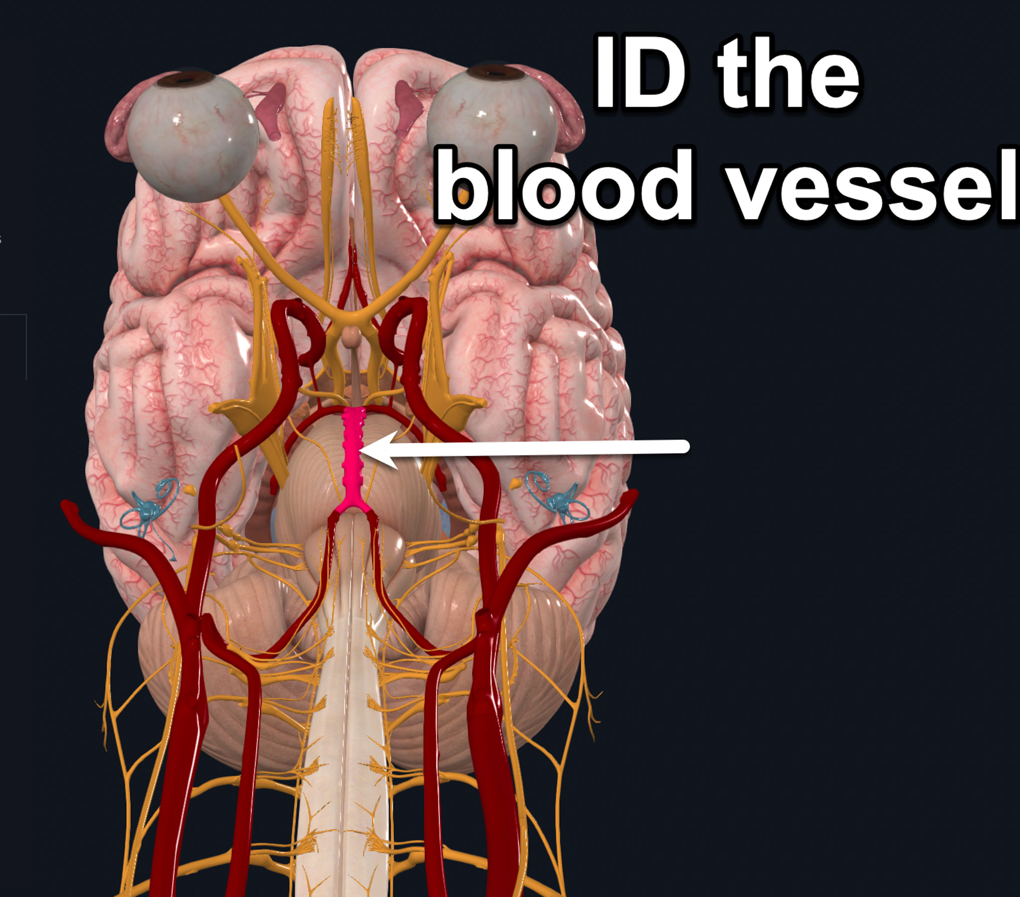 term image