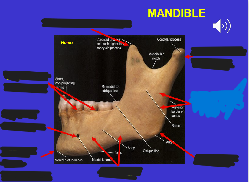<p>Angle  (in the mandible)</p>