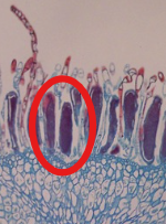 <p>Which part of the Antheridial Head is this?</p>