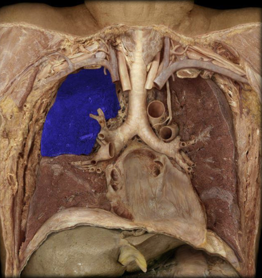 What structure is highlighted in blue?