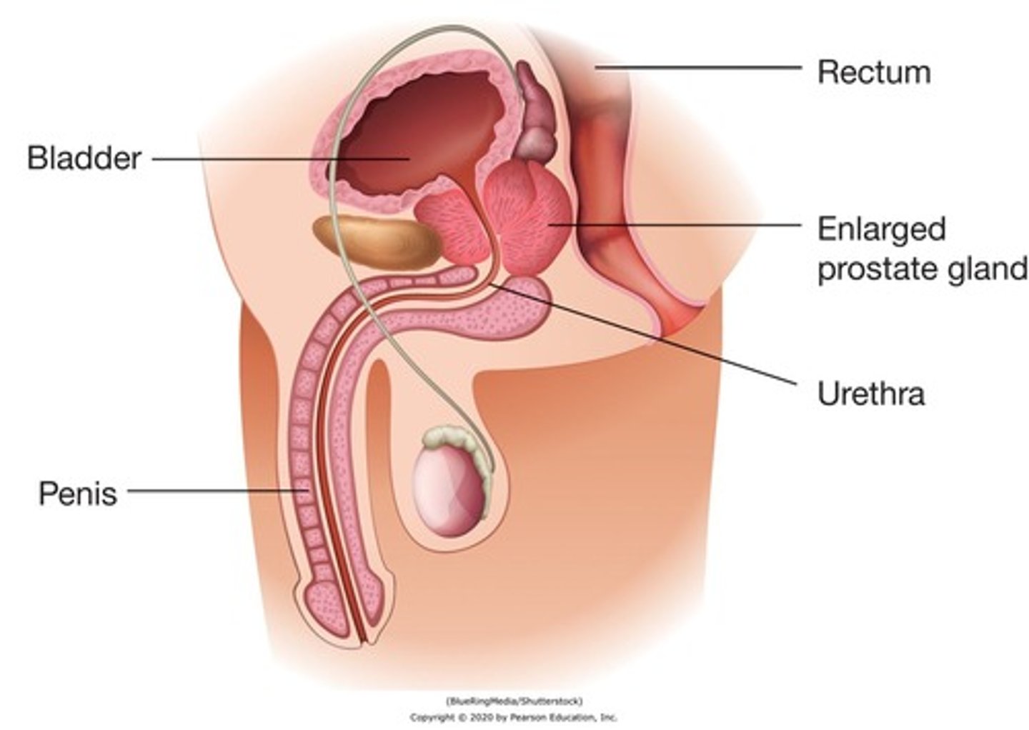 <p>Diverticulum, pouch</p>