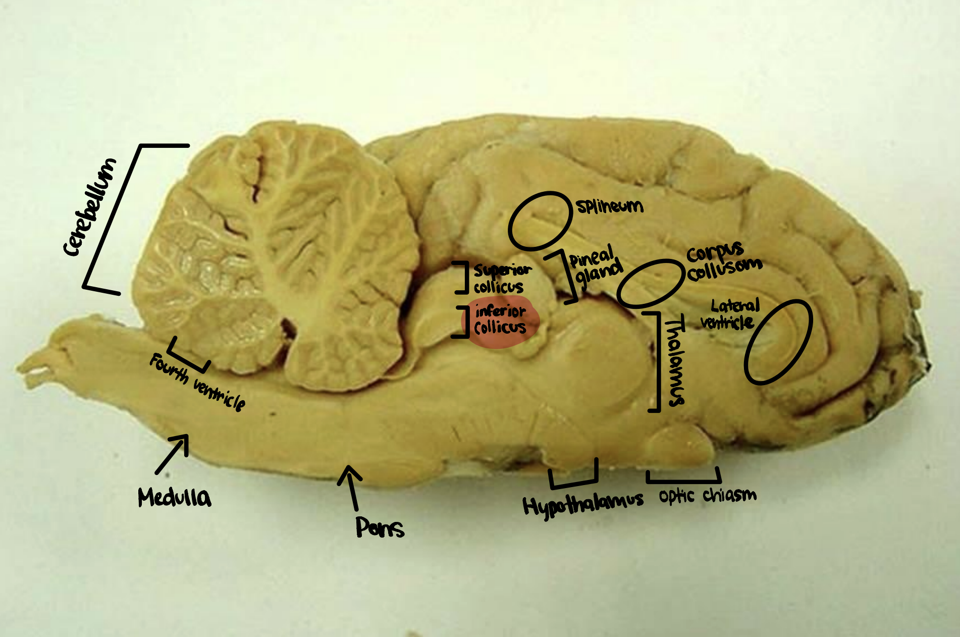 <p>Inferior Colliculus</p>