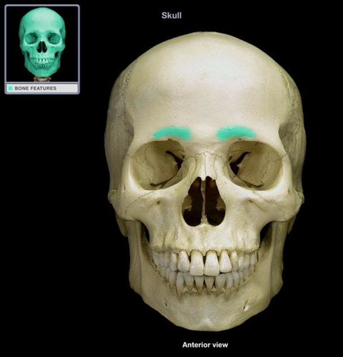 <p>bony projection in the eyebrow area of the frontal bone</p>