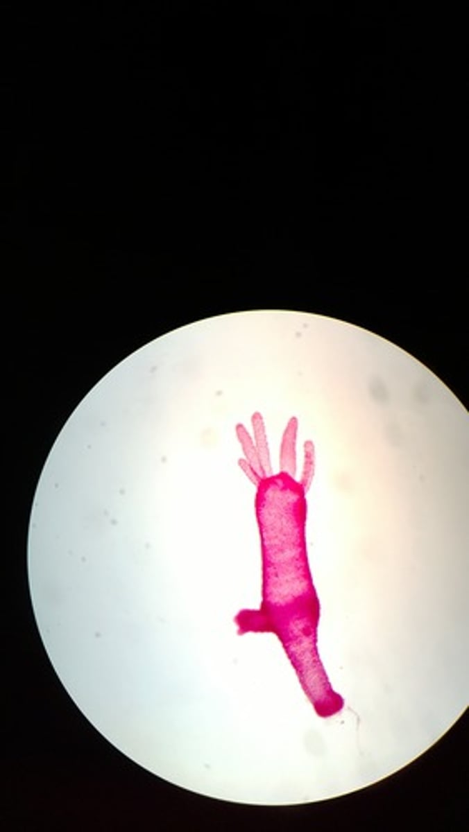 <p>-stinging cells called nematocysts (from nematocytes)</p><p>-solitary</p>