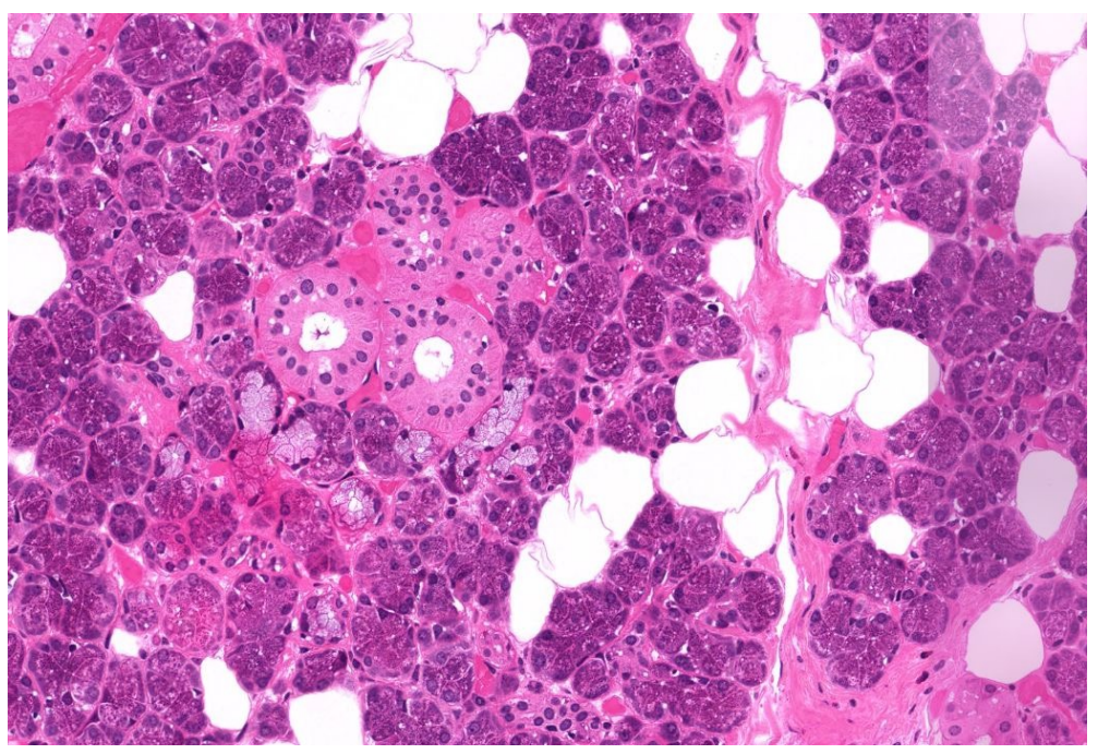 <p>What gland is this</p>