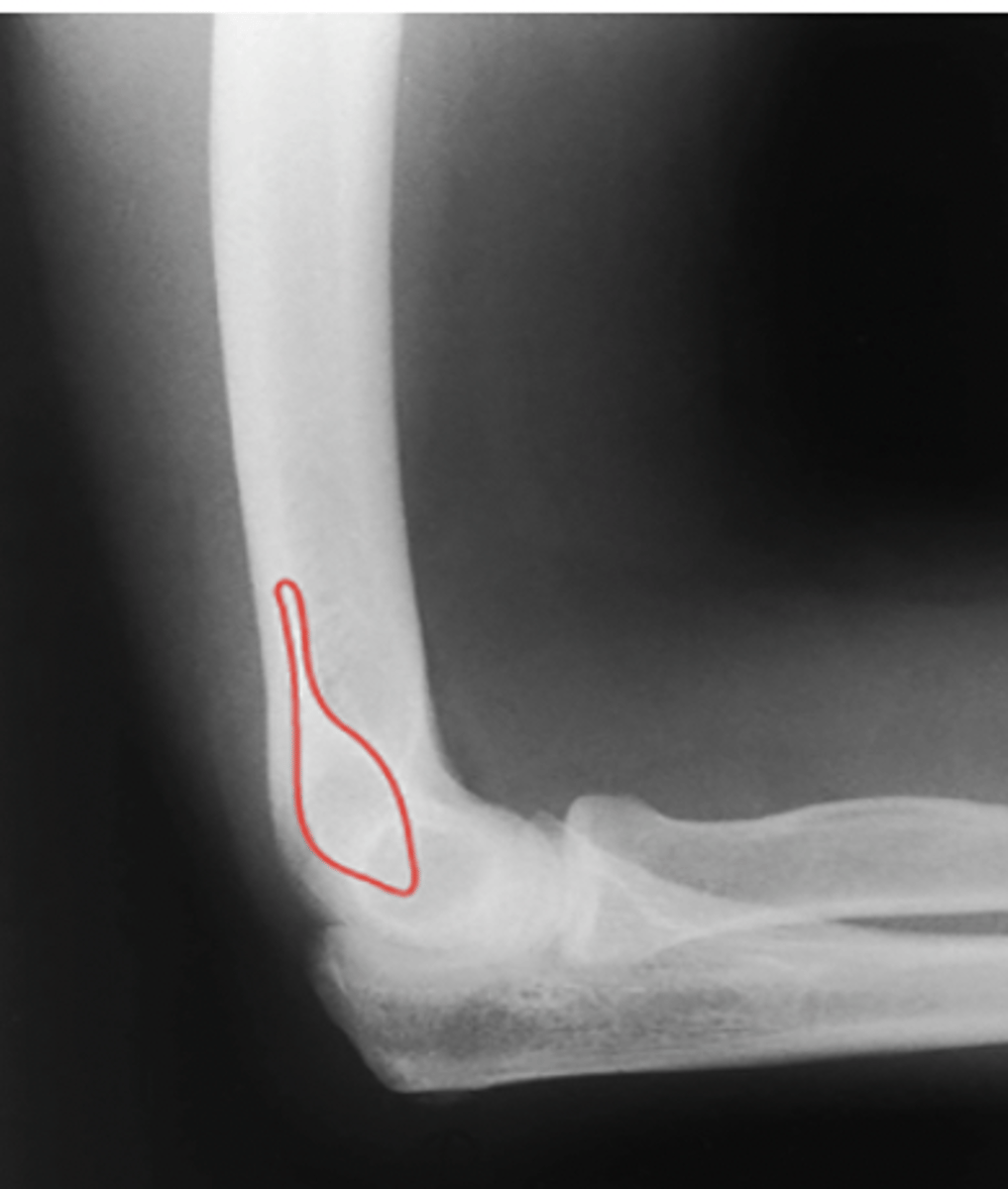 <p>What structure is highlighted?</p>