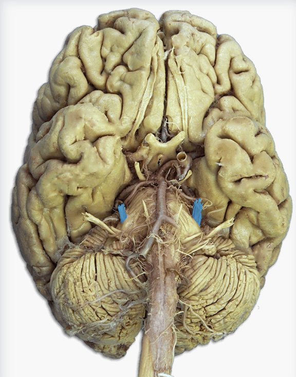 <p>Label this cranial nerve</p>
