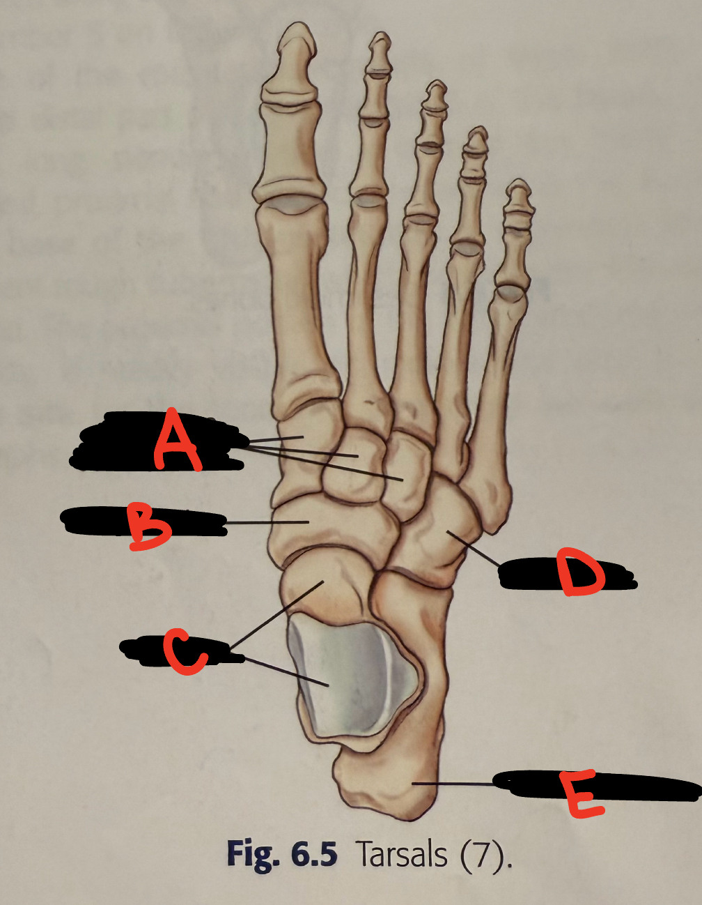 <p>B</p>