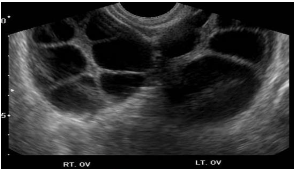 <p>28 yo pt. which hx questions would provide pertinent information</p><p>.</p><p>a) are you using any form of birth control</p><p>b) have you had a fever</p><p>c) have you had a urine or blood test performed to check for a possible pregnancy</p><p>d) are you currently being treated for infertility</p>