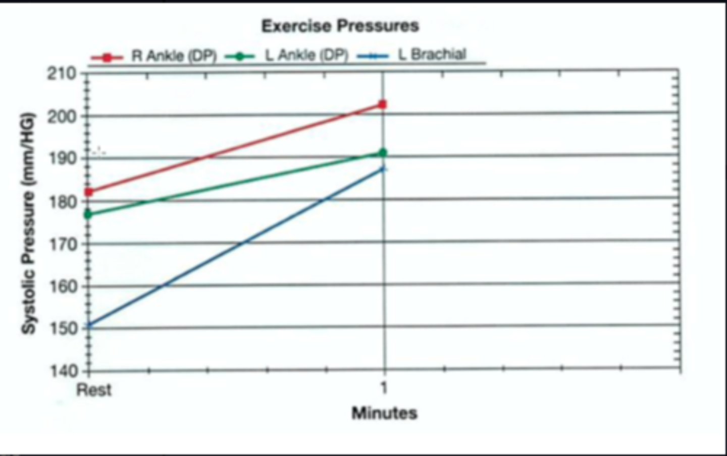 <p>Normal response to exercise</p>