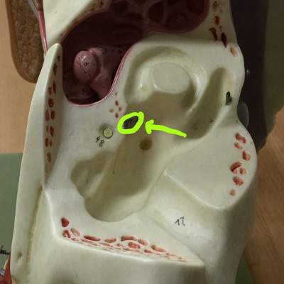 term image