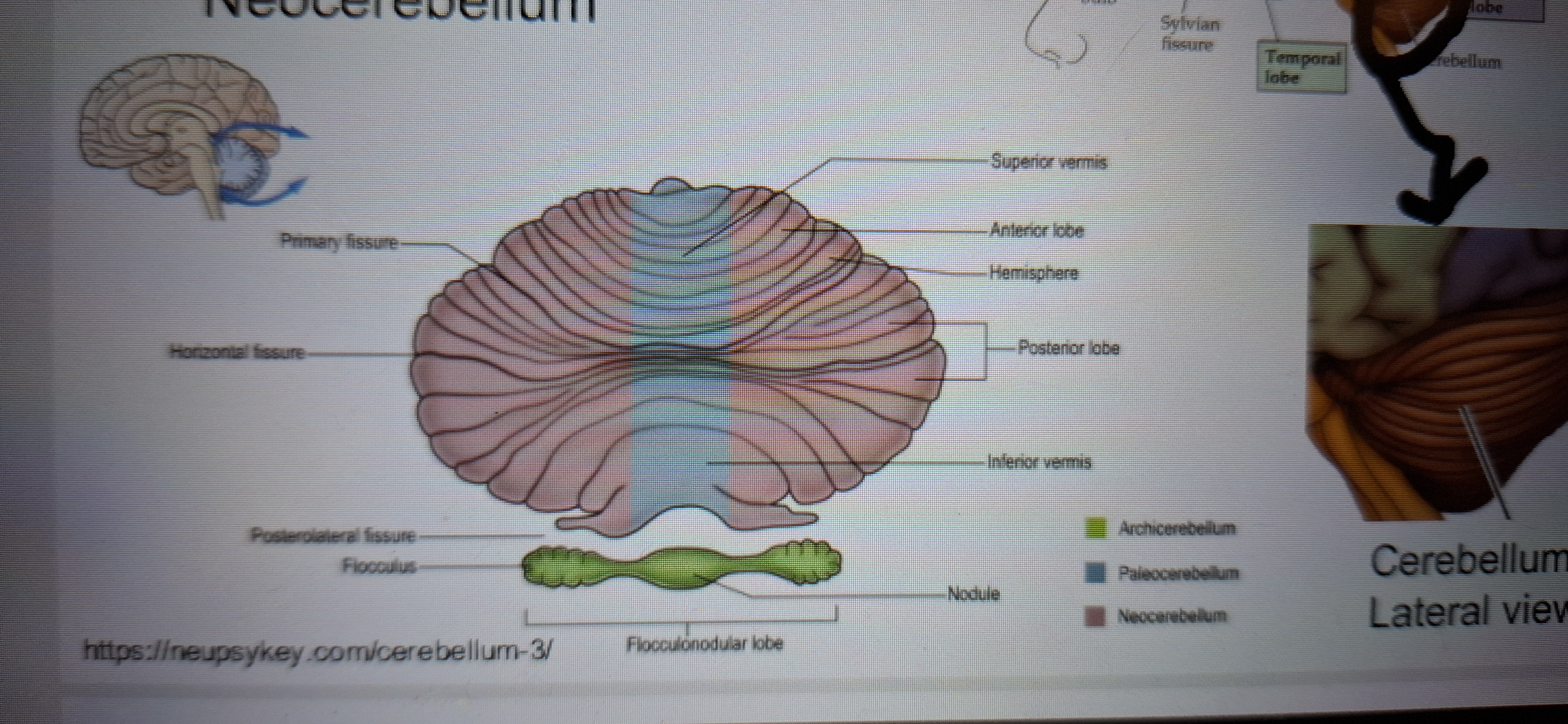 <p>Archicerebellum</p><p class="has-focus">Paleocerebellum</p><p class="has-focus">Neocerebellum</p>