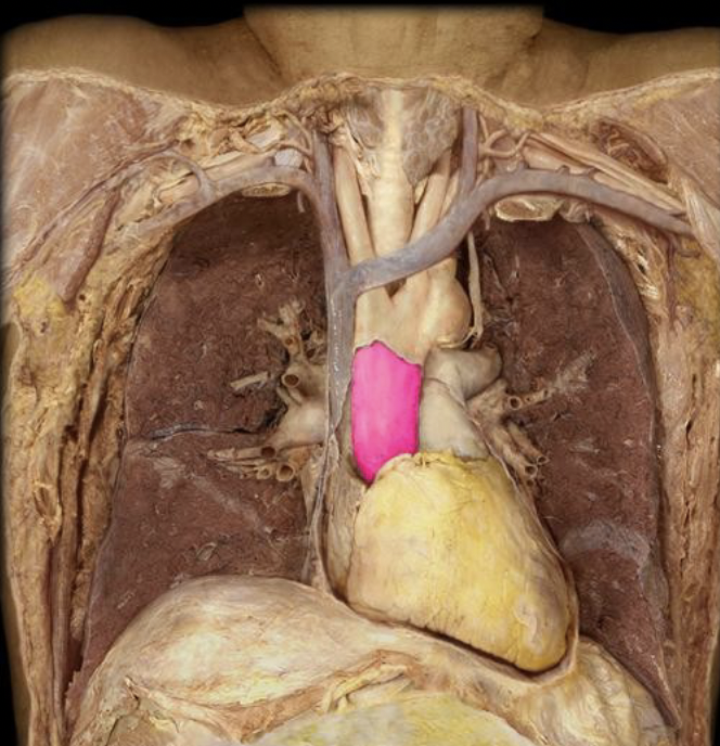 <p>what is this blood vessel that branches off the heart?</p>
